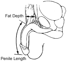 med_1019853790-penile_length.gif